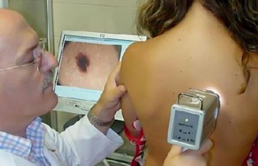 Radioterapia del cáncer de piel
